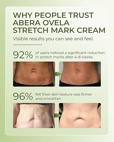 Ovela Maternity Stretch Mark Cream