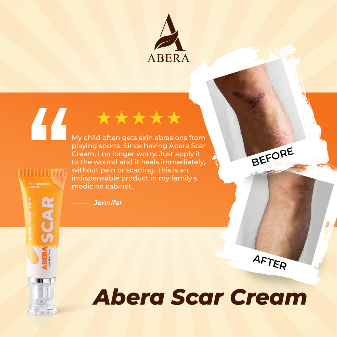 Crème ABERA anti-cicatrices au curcuma rouge