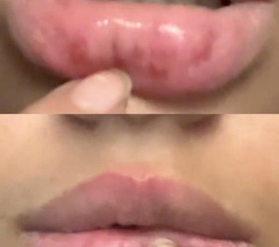 CA - Belani Fordyce Seeds - Lip Lightening Cream for Dark Lips, Lip Scrubber & Fordyce Spots, Chapped or Pigmented Lips, Moisturizing Lip Care Balm  – 20ml