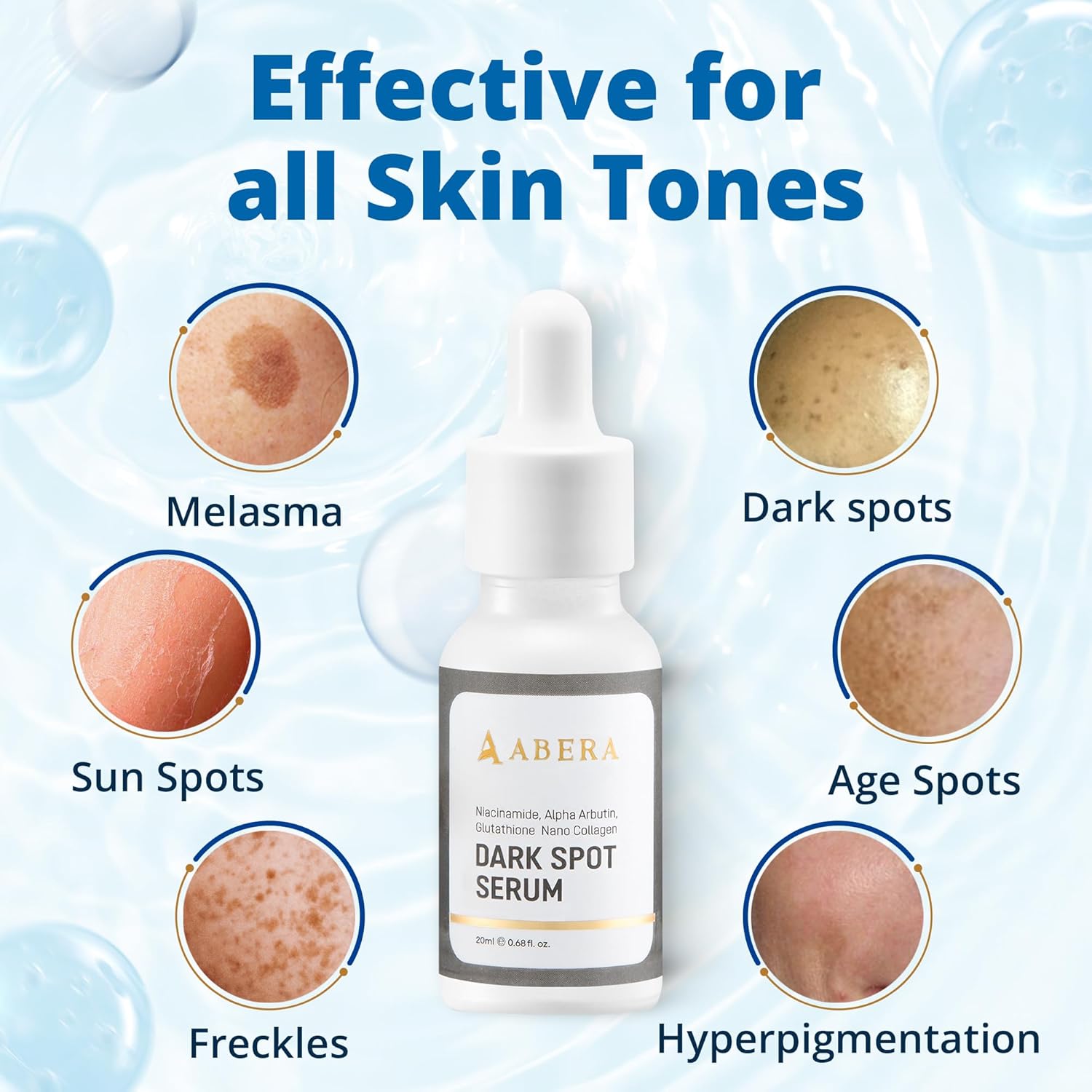 Abera Dark Spot Serum – Targeted Corrector for Melasma, Freckles & Hyperpigmentation (0.68 Fl. Oz)