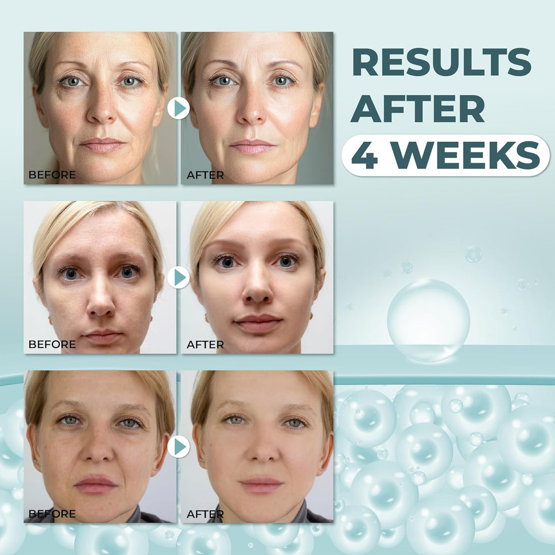 Crème Visage Anti-Rides Abera, Hydratant Anti-Âge pour Rides et Ridules