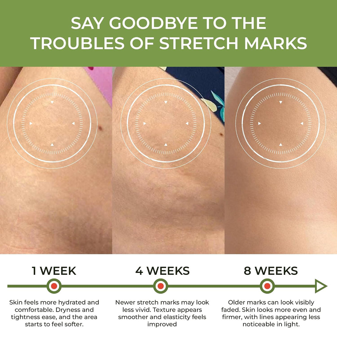 Ovela Maternity Stretch Mark Cream