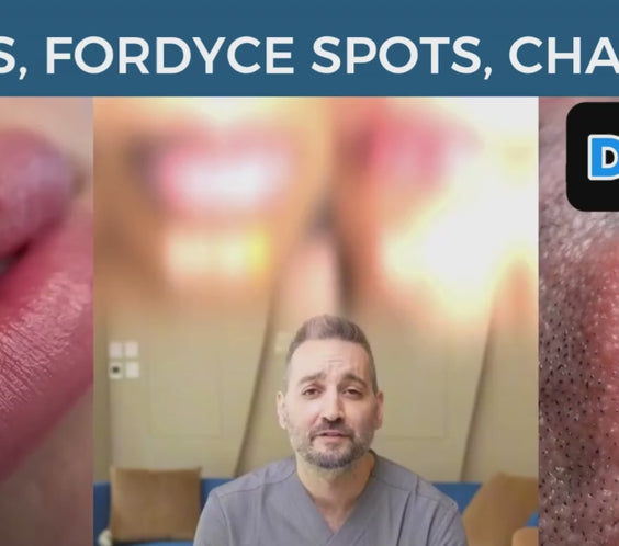 CA - Belani Fordyce Seeds - Lip Lightening Cream for Dark Lips, Lip Scrubber & Fordyce Spots, Chapped or Pigmented Lips, Moisturizing Lip Care Balm  – 20ml